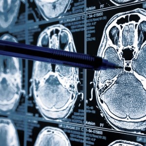 Healthcare, Healthcare data annotation, Medical annotation services, Medical annotation, medical labelling services, medical annotation service, Medical AI Services, medical annotation companies