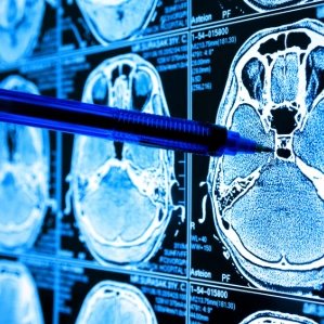 Healthcare, Healthcare data annotation, Medical annotation services, Medical annotation, medical labelling services, medical annotation service, Medical AI Services, medical annotation companies