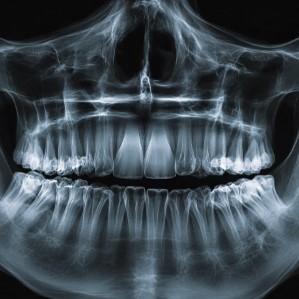 Healthcare, Healthcare data annotation, Medical annotation services, Medical annotation, medical labelling services, medical annotation service, Medical AI Services, medical annotation companies