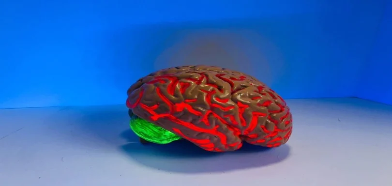 Machine Learning to Treat Neurodegenerative Disease Machine Learning to Treat Neurodegenerative Disease