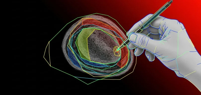 What is Polygon Annotation
